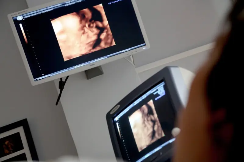 Monitor de ecografía mostrando imágenes médicas en un entorno hospitalario.